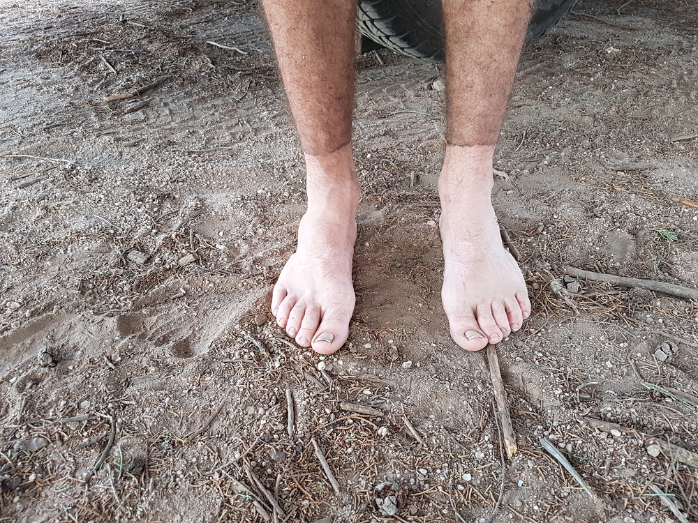 Clean feet and legs that are dirty with black ash from the fire showing distinct sock marks 